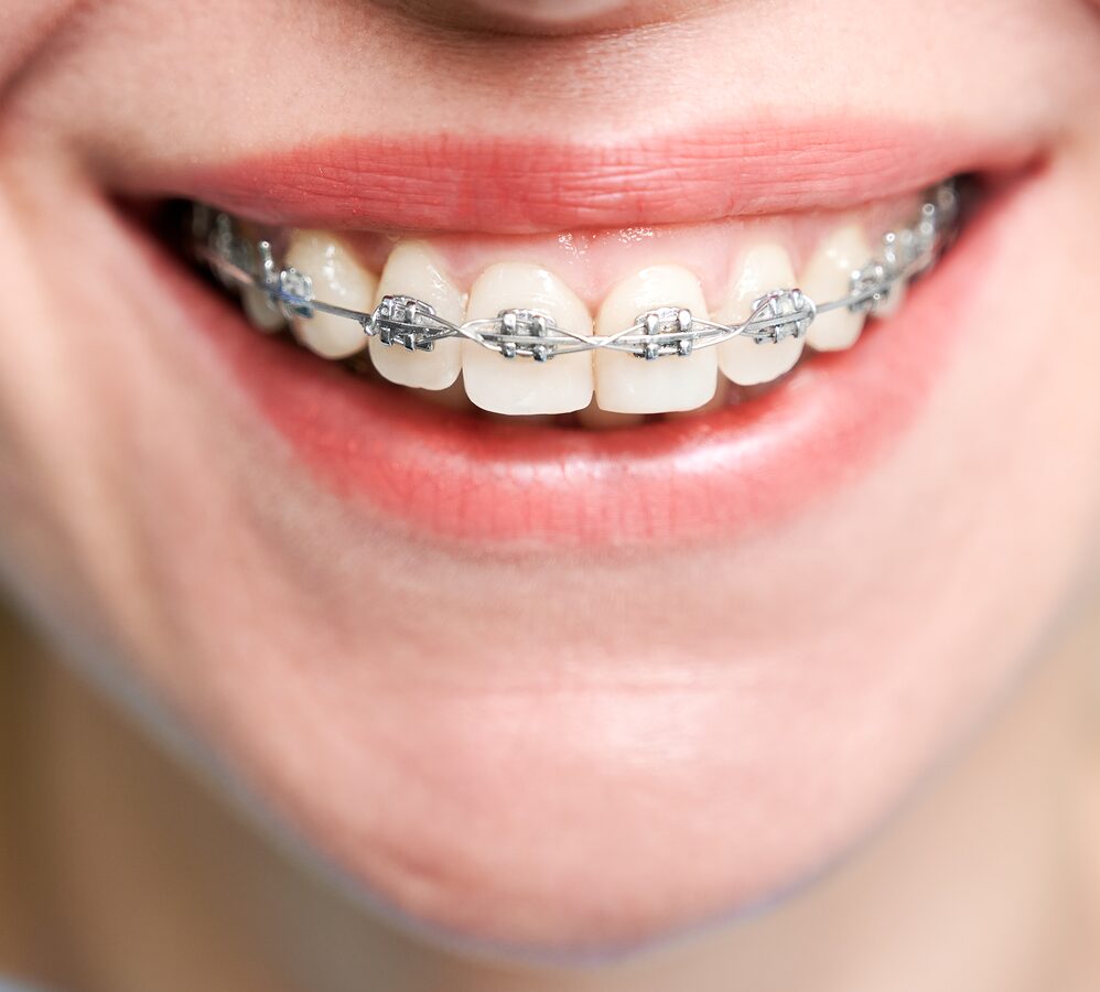Orthodontics